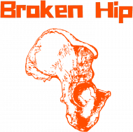 Broken Hip